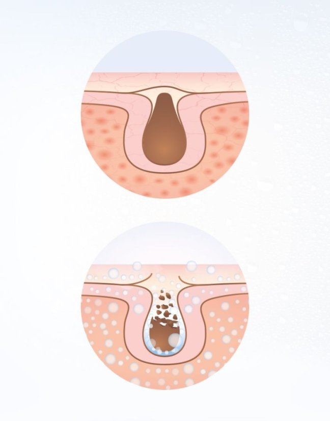 Parní inhalátor Lanaform Facial Care